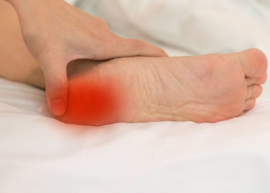 Sperone Calcaneare: devo operarmi?