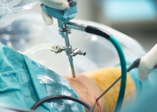 Operazione menisco: Intervento e riabilitazione post operatoria