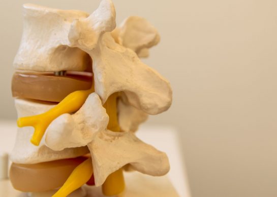 Spondilolisi: diagnosi e trattamento