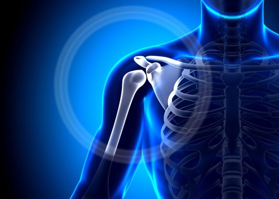 Artrosi acromion claveare: cura e riabilitazione